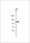 Zebrafish tie2 Antibody (N-term)
